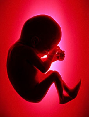 Foetus