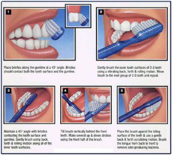 gums
